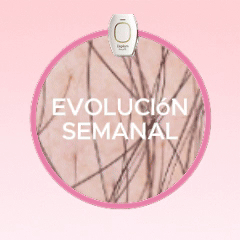 Depilum Nova IPL™